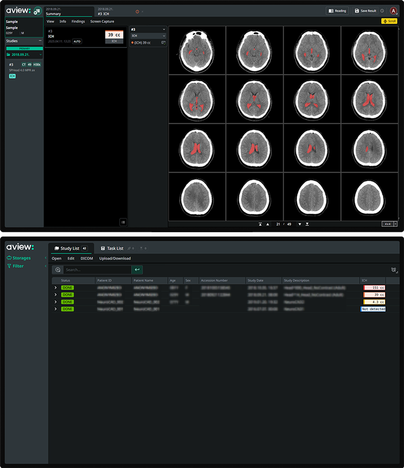 AVIEW Neuro