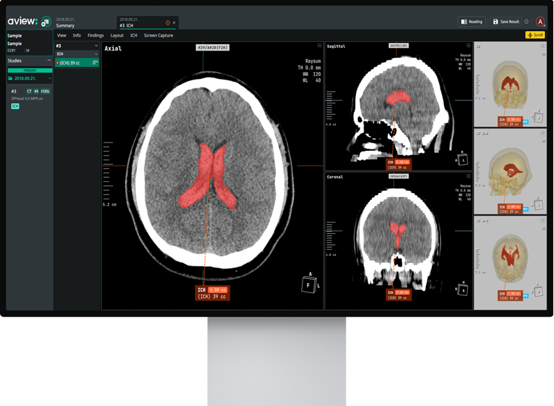 AVIEW Neuro